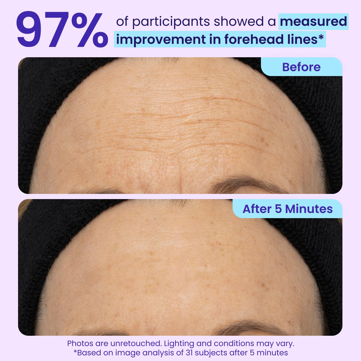 Free Shipping NEW Instant Lift Eye Gel - For the look of Puffiness & Bags, Wrinkles, Fine Lines and Dark Circles, Anti Aging Skin Care for Men & Women with Collagen Targeting Biotech