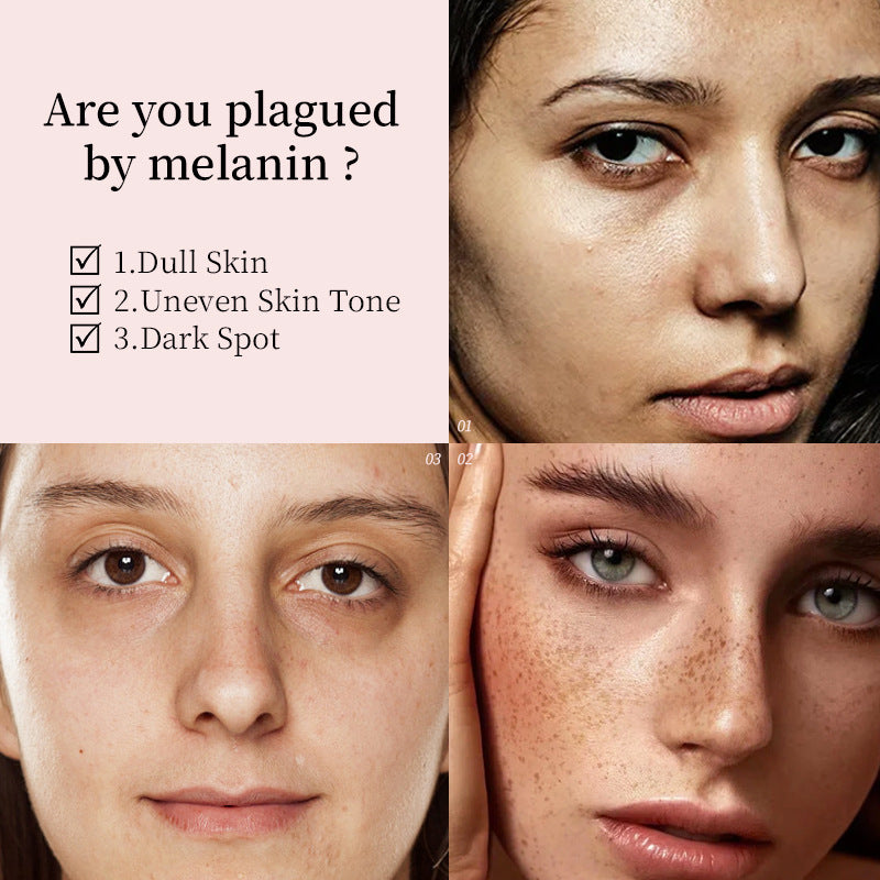 Dark Spot Fading Whitening Face Serum Brighten Skin Tone Fade Freckles Melasma Sun Age Spots Hydrating Anti Oxidant Anti Aging  whitening dark spot fading essence fading dark spots on face whitening dark spots