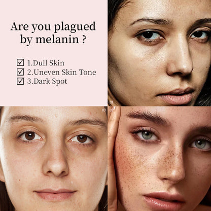 Dark Spot Fading Whitening Face Serum Brighten Skin Tone Fade Freckles Melasma Sun Age Spots Hydrating Anti Oxidant Anti Aging  whitening dark spot fading essence fading dark spots on face whitening dark spots