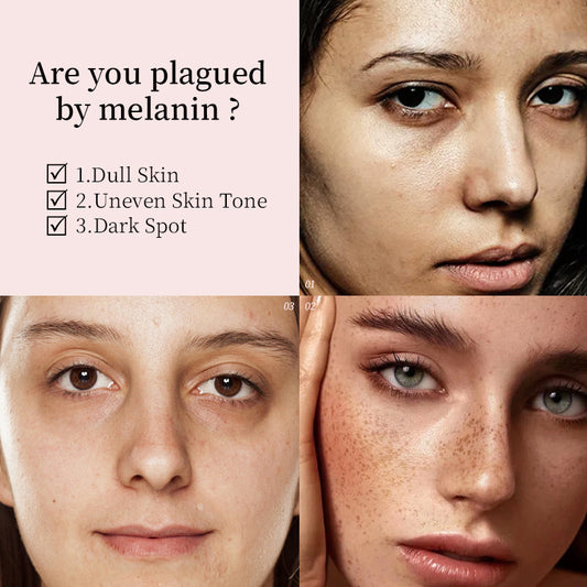 Dark Spot Fading Whitening Face Serum Brighten Skin Tone Fade Freckles Melasma Sun Age Spots Hydrating Anti Oxidant Anti Aging  whitening dark spot fading essence fading dark spots on face whitening dark spots