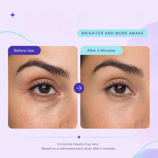 Free Shipping NEW Instant Lift Eye Gel - For the look of Puffiness & Bags, Wrinkles, Fine Lines and Dark Circles, Anti Aging Skin Care for Men & Women with Collagen Targeting Biotech